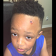 Illustration for article titled Alabama School Apologizes After Teacher Paints Fake Bullet Wound on Black Student’s Forehead